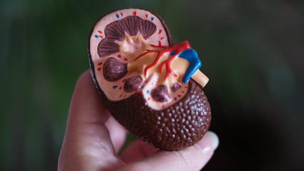 Anatomic model of a kidney