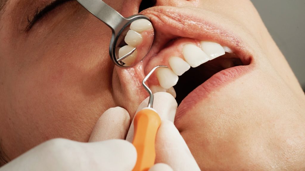 Dentist checking teeth