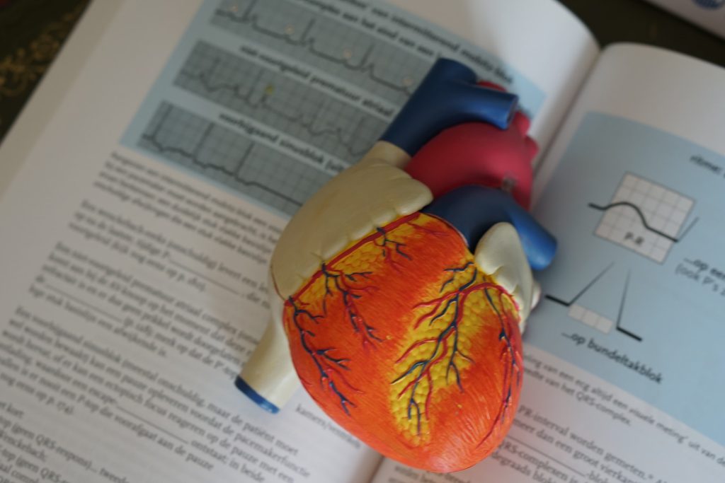 Anatomical model of a human heart