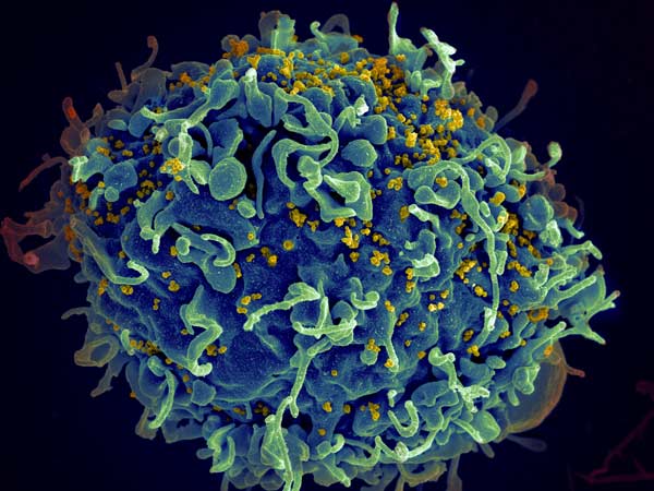 HIV invading a human cell