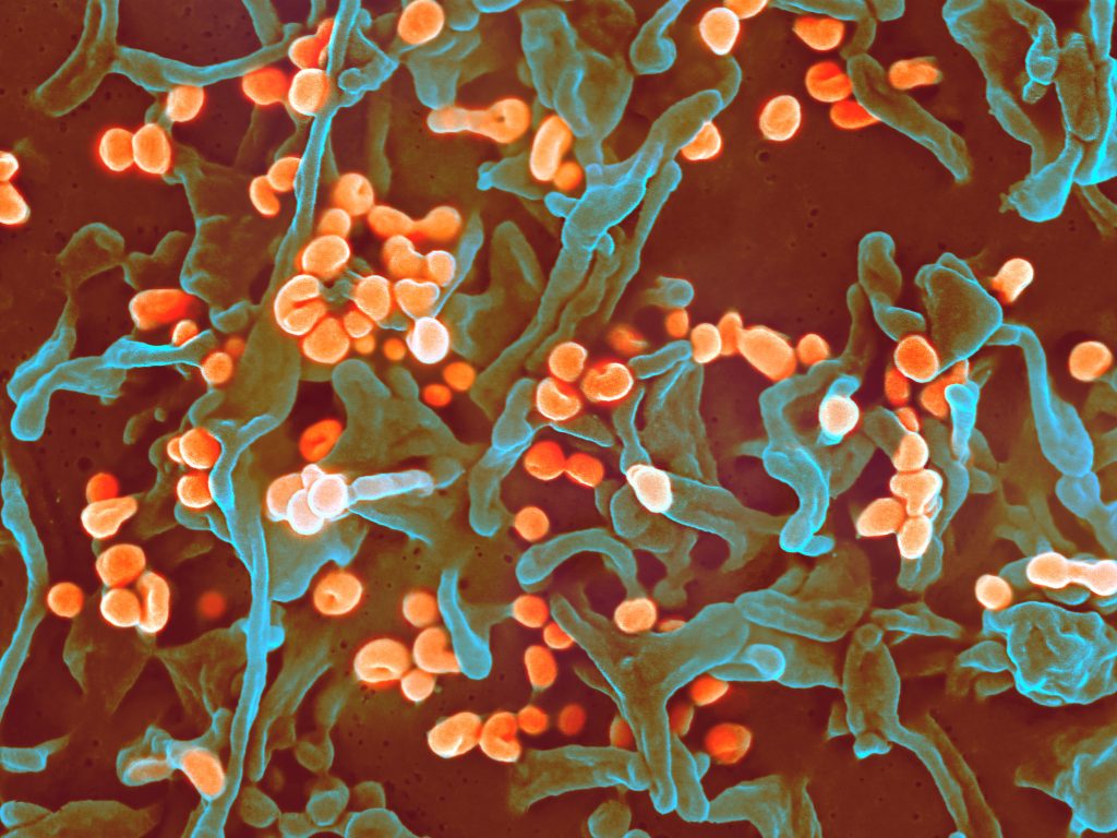 Lassa virus scanning electron micrograph